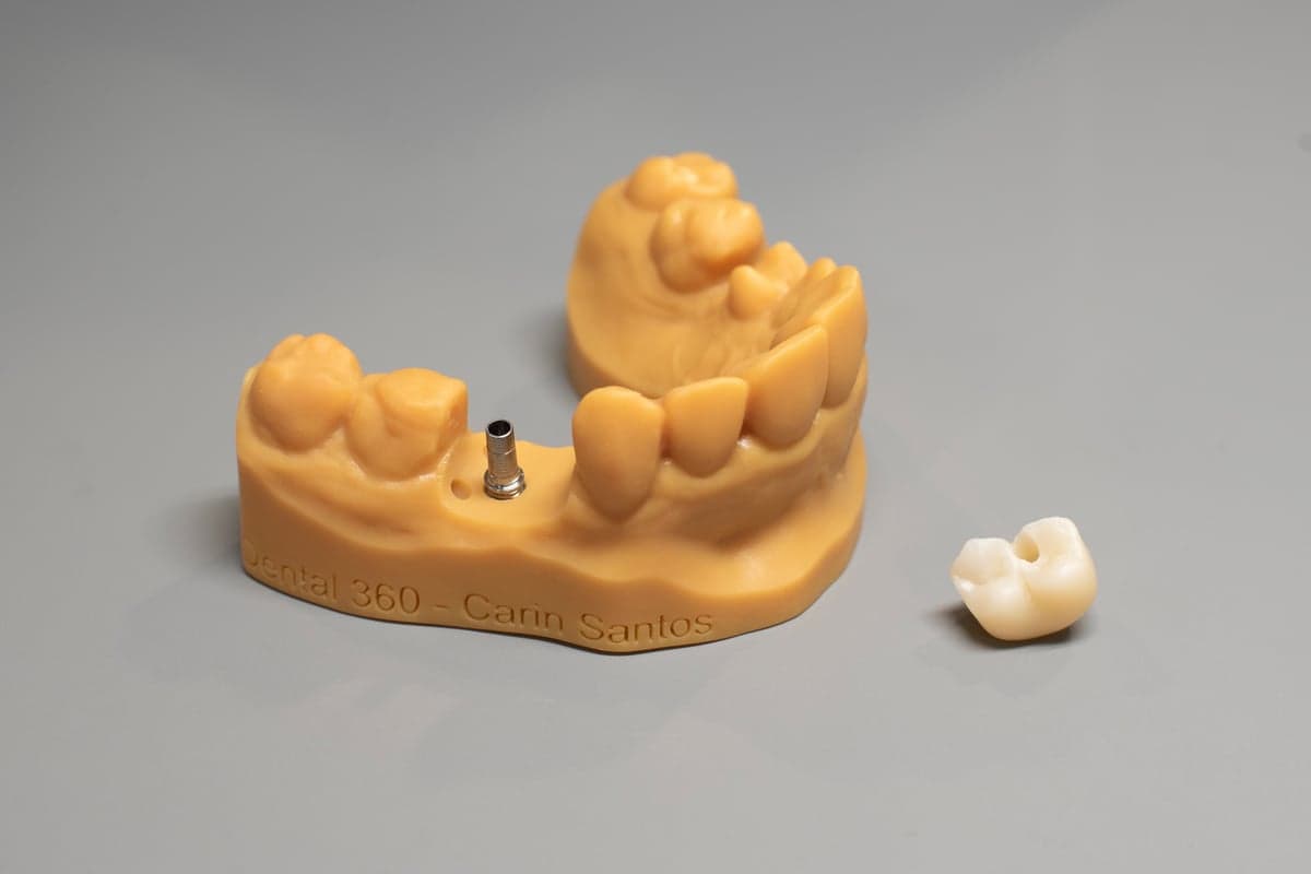 Teeth